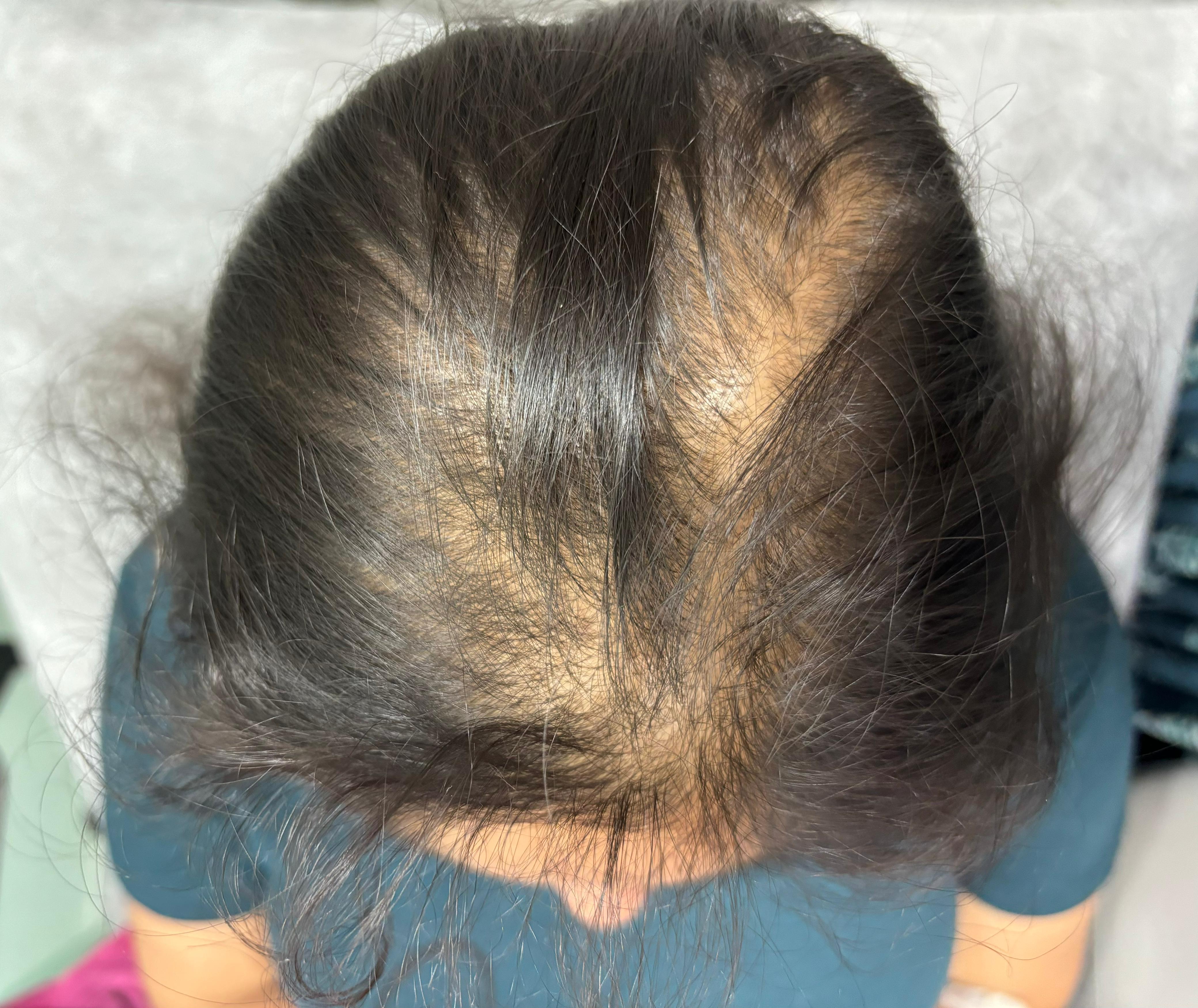 Before treatment case 01