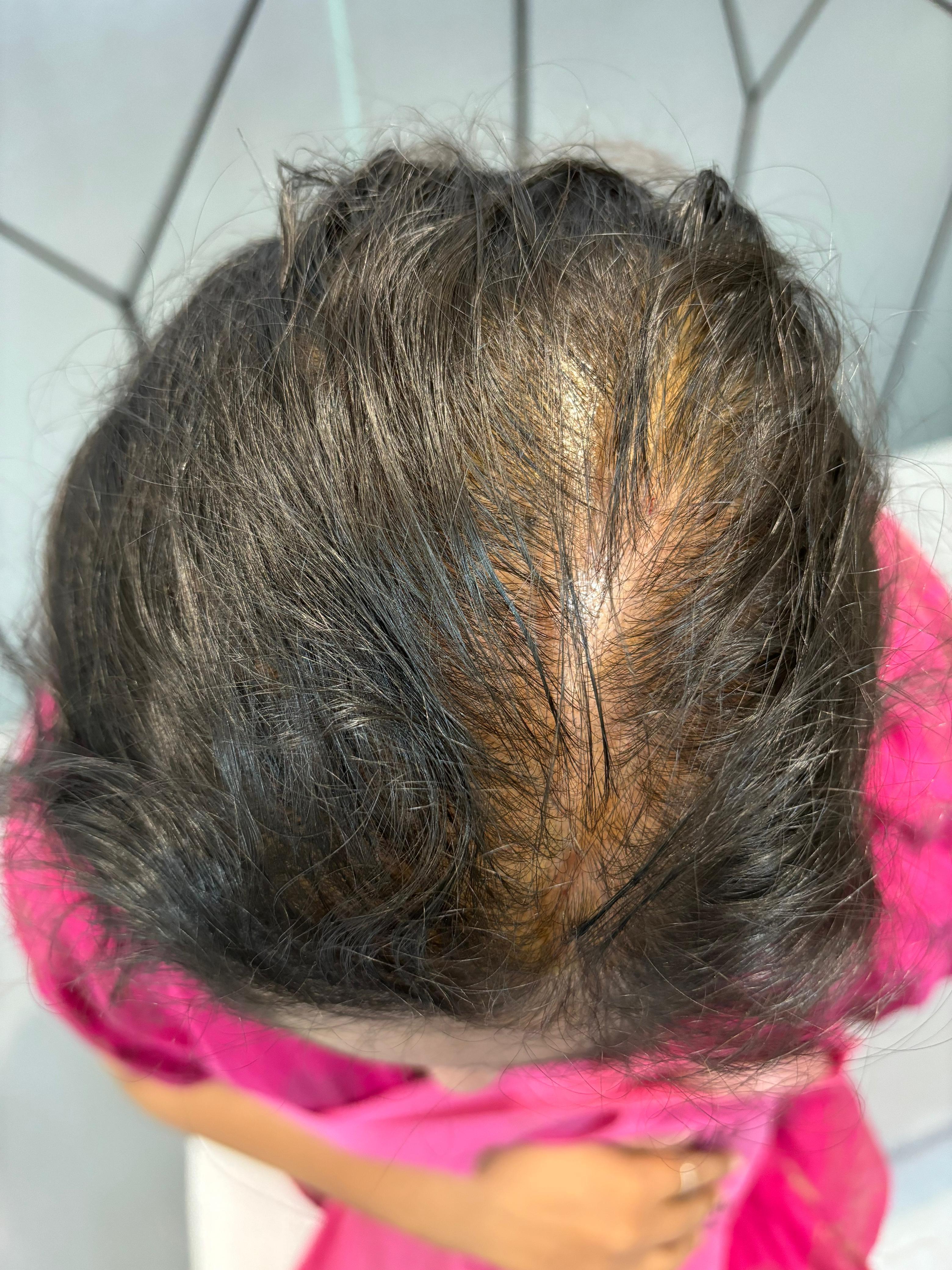 After treatment case 01