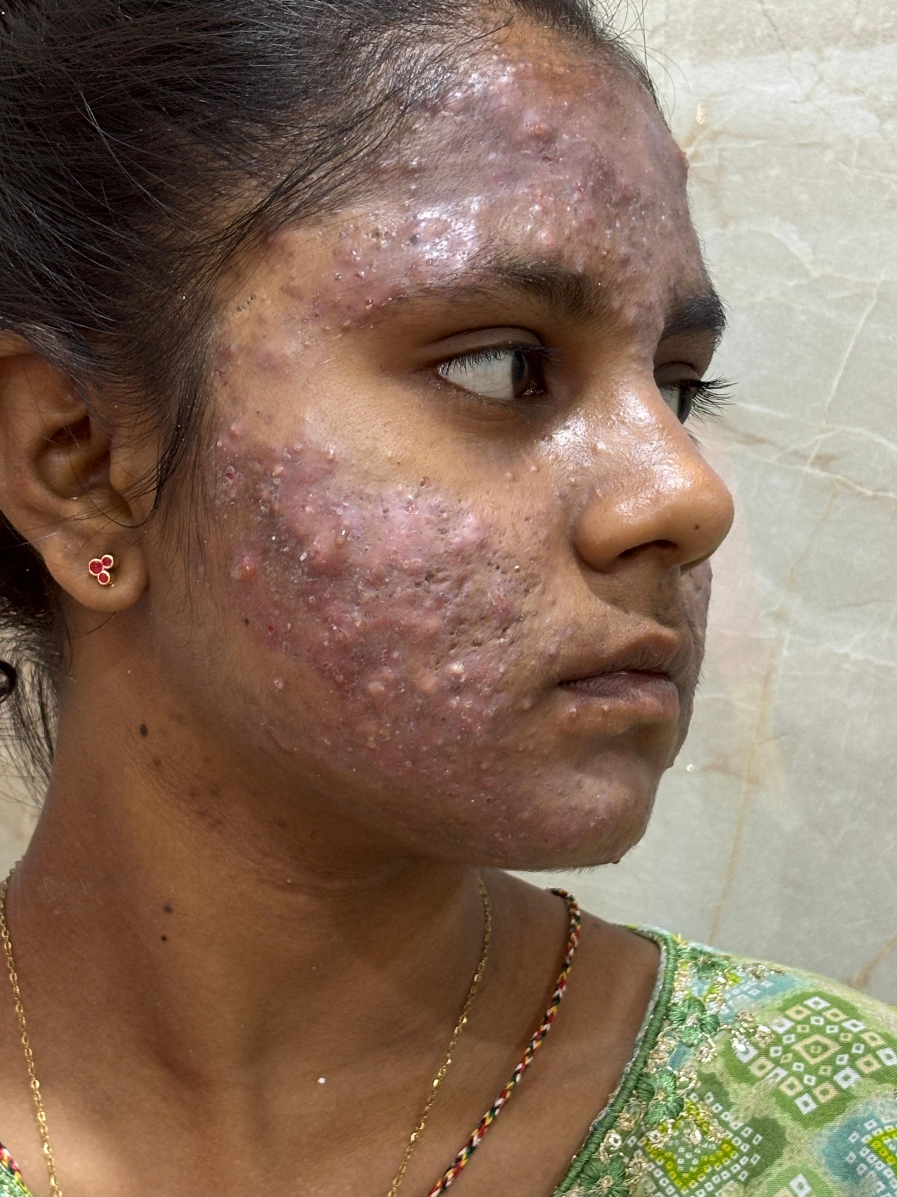 Before treatment case 02