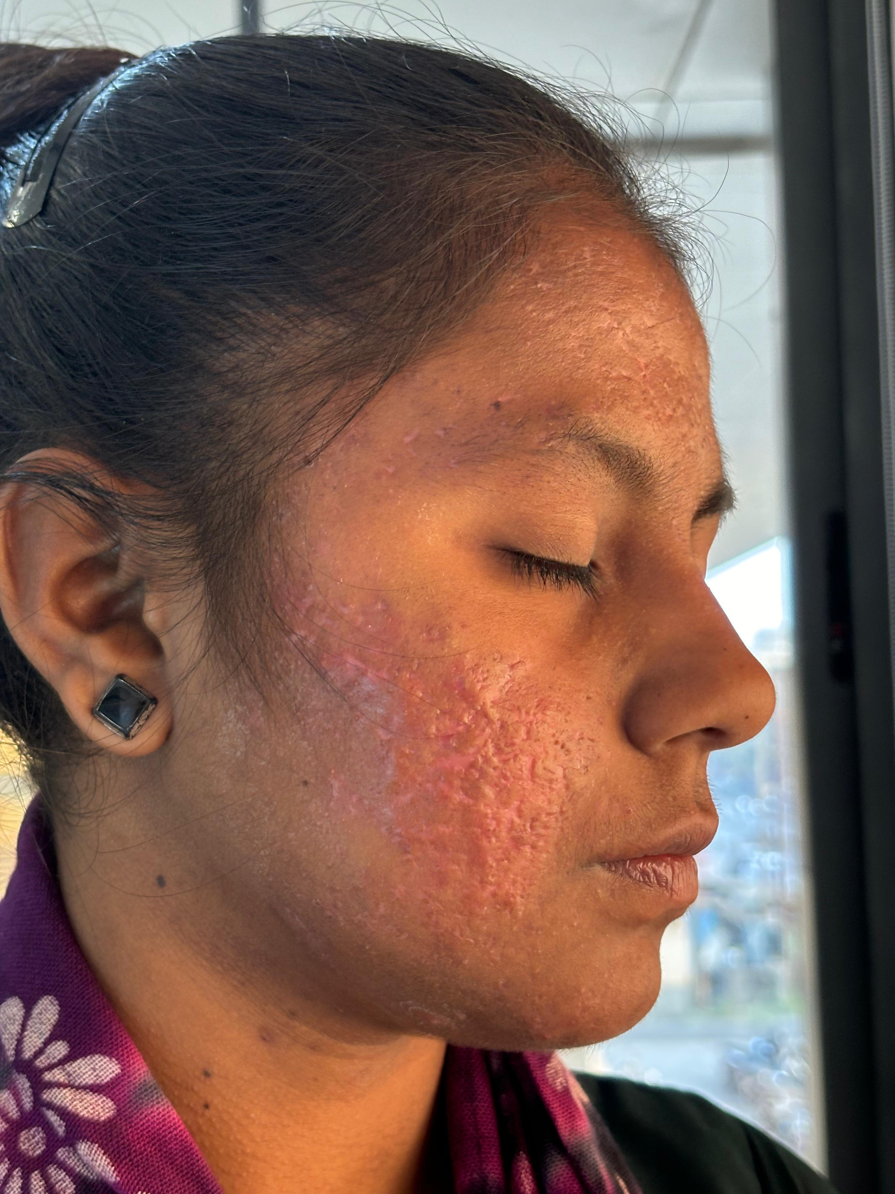 After treatment case 02