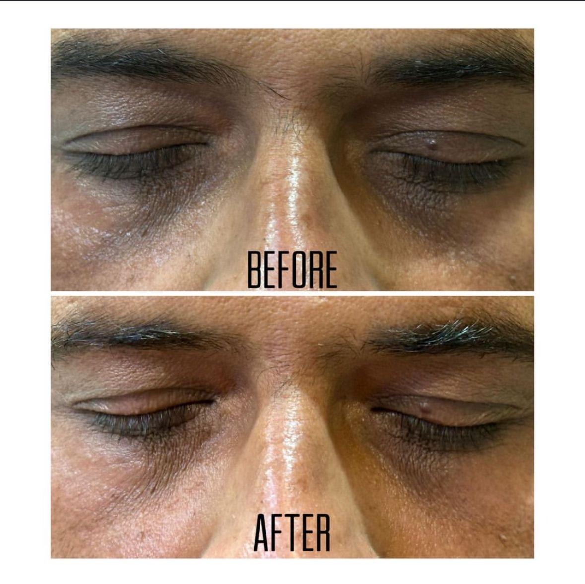 Treatment spotlight case 03