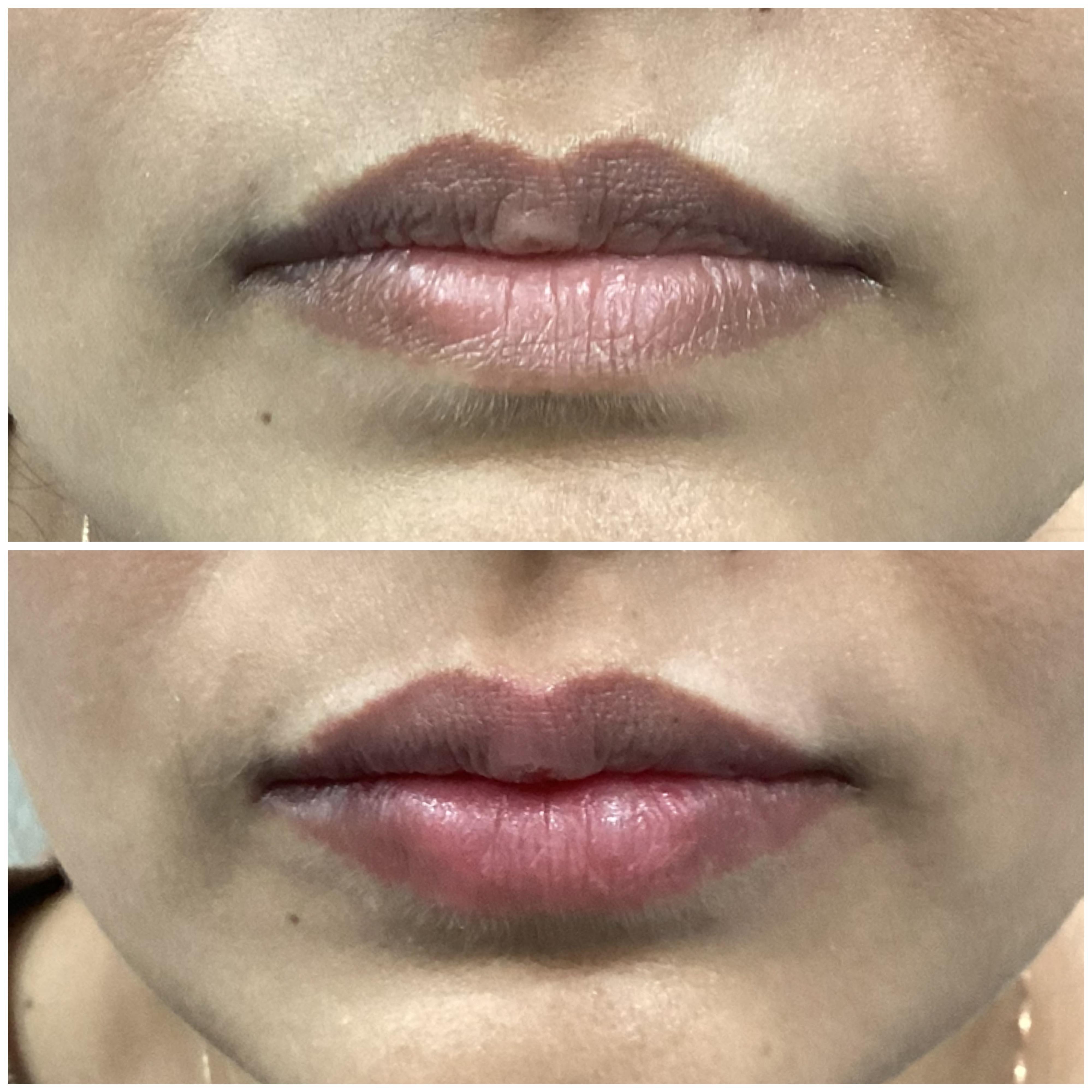 Treatment spotlight case 05