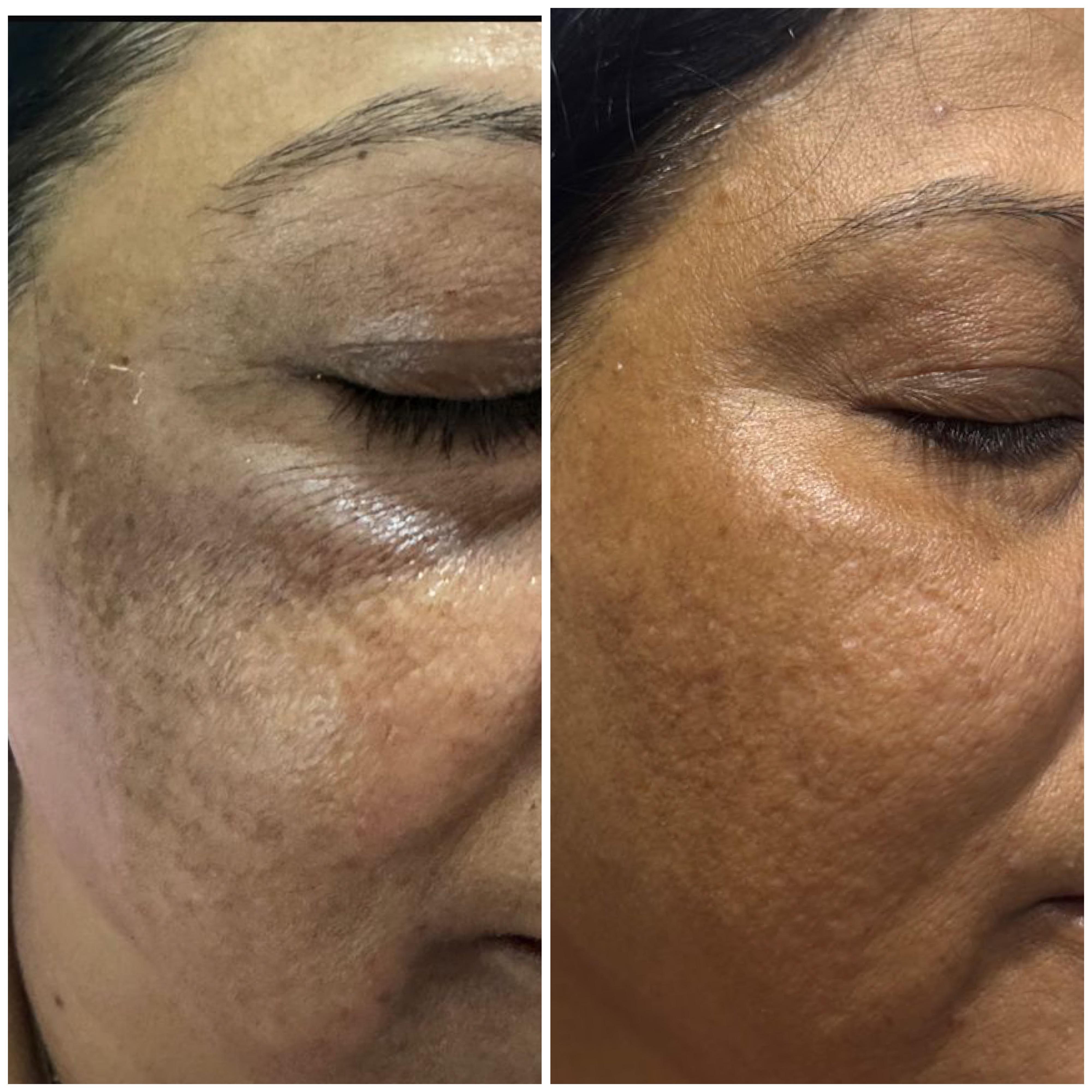 Treatment spotlight case 06